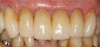 (25.) Final postoperative image.