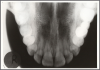 Figure 64 - Maxillary Topographical Occlusal Image