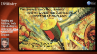 Finishing and Polishing: Tooth Colored Adhesive Restorations and Natural Tooth Structure Webinar Thumbnail