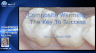 Composite Warmers: The KEY to Success in Direct Composites Webinar Thumbnail