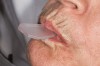 Figure 5  Instruct patients to close onto their back teeth, and create suction with their lips.