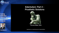 Treating Edentulous Patients, Part 2 – Prosthodontic Solutions Webinar Thumbnail