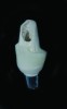 Fig 5. A screw-retained provisional PEEK abutment is converted to a cement-retained provisional abutment abutment. Notice the abutment used is engaging (peaks are present on the abutment to prevent rotation).