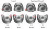 Figure 1. Location of bleeding sites per group at Baseline and Week 6.