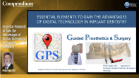 Essential Elements to Gain the Advantages of Digital Technology in Implant Dentistry Webinar Thumbnail