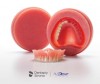 Figure 1: One of Avadent’s options is to have each denture tooth adhered into place.