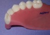 Figure 3: Cross-sectional view of Avadent’s one-piece denture.