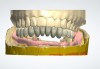 Figure 10: 3Shape denture module software designing denture.