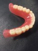 Figure 17: Final denture from Dentca ready for delivery.