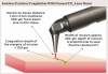 Fig 4. Laser-tissue incision with focused (0.25-mm spot) laser beam. Defocused beam (approximately 0.8-mm spot with nozzle approximately 10 mm from the tissue) with reduced fluence coagulates the tissue.