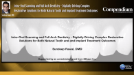 Intra-Oral Scanning and Full Arch Dentistry - Digitally Driving Complex Restorative Solutions for Both Natural Tooth and Implant Treatment Outcomes Webinar Thumbnail