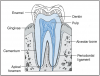 Figure 13 – Divisions and Tissues of a Tooth (Courtesy of The Anatomy and Physiology Learning System, 2nd Ed, Applegate, E., p. 333). Parts of the teeth and surrounding tissues.