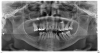 Fig 1. Digital radiography allows dental offices to acquire a quality image within seconds.