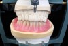 The final wax setup of the final mandibular complete denture was articulated against a stone cast of the existing final maxillary
complete denture.
