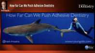 How Far Can We Push Adhesive Dentistry Webinar Thumbnail