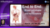 End to End: GI Tract Pathologies and their Oral Manifestations Webinar Thumbnail