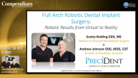 Robotic Full Arch Surgery Webinar Thumbnail