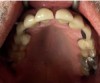 Fig 6. Case 1 intraoral photographs.