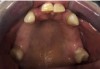 Fig 12. Case 3 intraoral photographs.