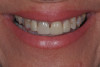 Fig 1. This patient presents with the goal of enhancing her smile.