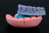Fig 3. 3D-printed model of the smile design. A silicon index was made to fabricate the provisional restorations.