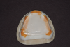 (7.) Gothic arch tracer striking plate held to white maxillary baseplate with orange sticky wax.