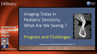 Are Dental X-rays Still an Option in Pediatric Dentistry? Webinar Thumbnail