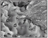 Figure 6 – This picture demonstrates how bone grows onto and into the porous structure of the TiUnite™ surface of the Nobel Biocare implants (Courtesy of Nobel Biocare)