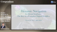 Dynamic Navigation for Dental Implants and Beyond – The Key to a Complete Digital Workflow Webinar Thumbnail