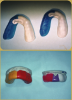 Fig 9. Vacuum-formed Mouthguards
