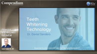 Advancing Whitening with Automation Webinar Thumbnail