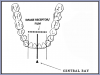 Figure 26 – Mandibular Central/Lateral Incisors