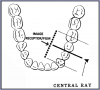 Figure 32 – Mandibular Premolars