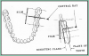 Figure 58 – Mandibular Molars