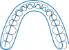 Fig 3. An example of a typical scanning strategy described by IOS manufacturers. In this example, a linear movement is carried out on all occlusal surfaces, and then the palatal and buccal surfaces.