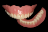Fig 9. Complete overdenture prostheses using acrylic resin and denture.