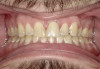 Fig 2. Extra-oral photography. All dental practices should provide the patient with the following four extra-oral photographs: the close-up smile (Fig 1), the retracted smile (Fig 2), the upper arch (Fig 3), and the lower arch (Fig 4).