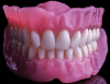 Fig 1. Dentsply Sirona’s Lucitone Digital Print polymer-based option for 3D printing dentures.
