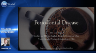 Periodontal Disease Update Webinar Thumbnail