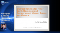 Indirect Bonding for Minor Tooth Movement and Comparison of Lingual Braces Vs. Aligners Webinar Thumbnail