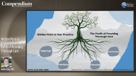 Hidden Perio in Your Practice – The Profit of Providing Thorough Care Webinar Thumbnail