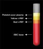 Fig 1. Components formed after centrifugation of fresh blood for 3 to 5 minutes in noncoated plastic tube (i-PRF = injectable PRF, RBC = red blood cells).