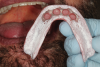 (5.) Achieving a uniform streaked appearance is ideal prior to placing the prosthesis onto the edentulous ridge.