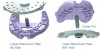 Fig 9. Pala’s Digital Denture tray allows for a customized fit to establish vertical and hold the jaw position.