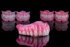 Fig 4. Exact duplicate dentures can be printed in less than 24 hours, without the need for any pre-delivery clinical appointments.