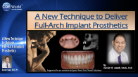 A New Technique to Deliver Full-Arch Implant Prosthetics Webinar Thumbnail