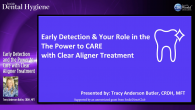 Early Detection and the Power to Care with Clear Aligner Treatment Webinar Thumbnail
