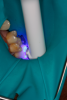 Fig 16. Adhesive was light-cured for 40 seconds due to the depth of the box preparation.