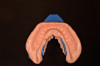Fig 4. Preoperative mandibular impression made from VPS.