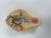 Fig 6. The denture teeth are set in wax for a try-in.